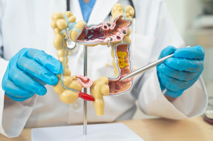 ulcerative-colitis-intestine-appendix-digestive-system-doctor-holding-anatomy-model-study-diagnosis-treatment-hospital_1263944-361